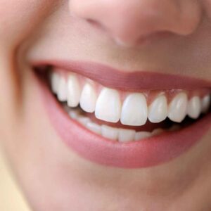 Laser Teeth Whitening with New Equipment